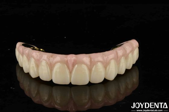 ความทนทานสูง Zirconia การแก้ไขที่สุดยอดสําหรับฟันธรรมชาติและยาง