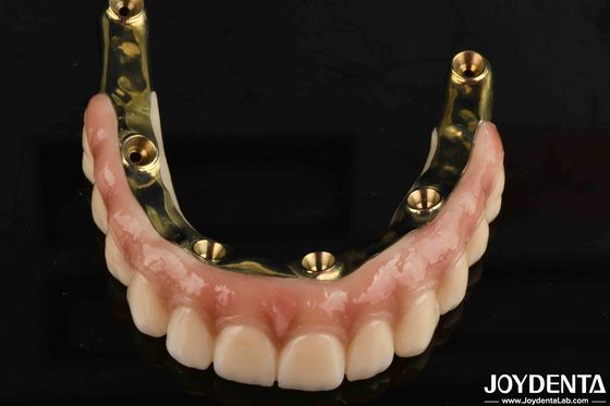 โปรเทสต์ฟัน สะพานไฮบริด Ti-Bar Zirconia ด้วยมาตรฐานความเข้ากันได้อย่างสูง