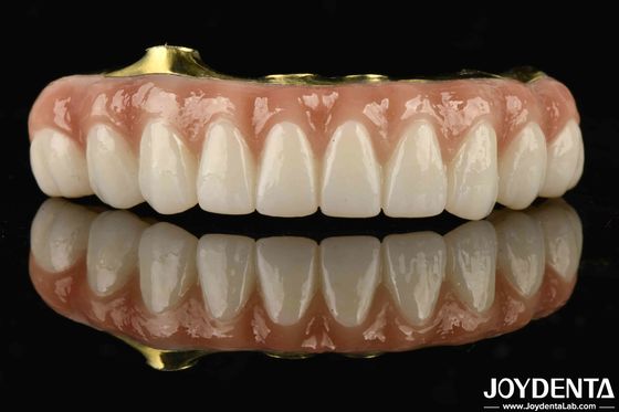 ทิตาเนียมและซิรคอนเนีย ความสะดวกสบาย สะดวกสบายในการสวม Ti-Bar Zirconia Hybrid Bridge สําหรับการเปลี่ยนฟันที่หายไป
