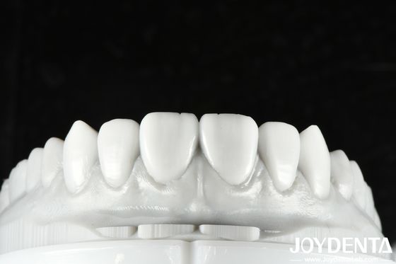 สีธรรมชาติฟัน Wax Up การแก้ไขที่หลากหลายสําหรับการฟื้นฟูฟันเดียวหรือหลายฟัน