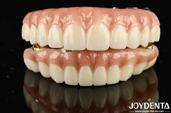 สะพานไฮบริด Ti-Bar Zirconia ความทนทานสูง เพื่อบรรลุความสวยงาม
