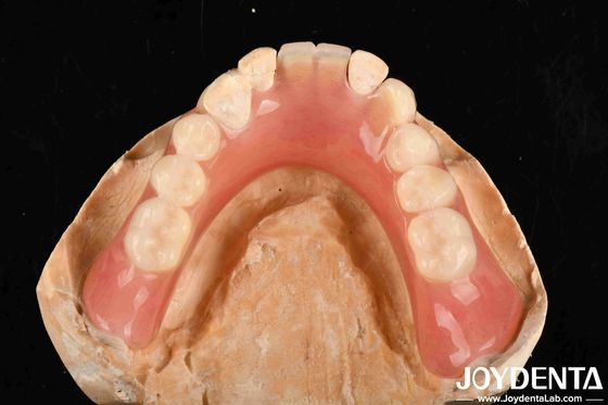 น้ําหนักเบา ดี Biocompatibility ปริมาณฟันปลอม Acrylic จบการปรับปรุงตามความต้องการของบุคคลในอุปกรณ์การแพทย์