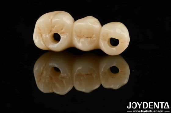 ความสวยงามสูง ความแข็งแรงในการบิดสูง 1000 MPa Zirconia เต็มสําหรับมาตรฐาน