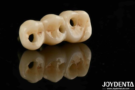 ความเหมาะสมทางชีวภาพที่ดีและความแข็งแรงสูง สีจริงเต็ม Zirconia สําหรับ B2B การจัดหาคําตอบ