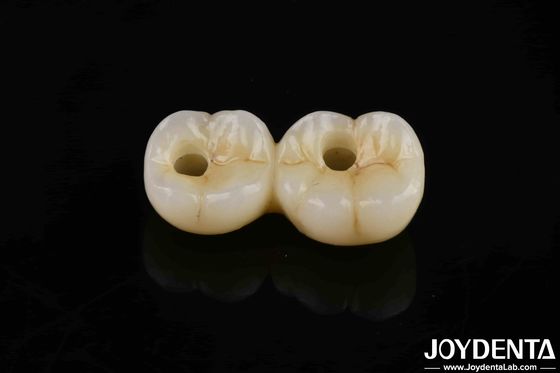 800 MPa ความแข็งแกร่งในการบิดหลายชั้น Zirconia เต็มความโปร่งใสสูงสําหรับการฟื้นฟูที่ทนทานและดูธรรมชาติ
