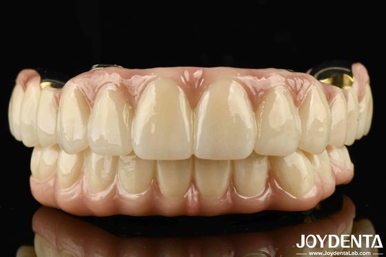 สะพานไฮบริด Ti-Bar Zirconia ความแข็งแรงที่ดีที่สุด สําหรับฟันและยางที่เข้ากันได้ตามธรรมชาติ