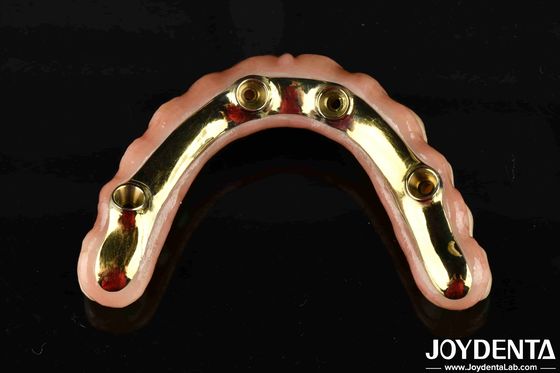 สะดวกสบายในการสวม Ti-Bar ฟื้นฟูฟังก์ชันการเคี้ยว Ti-Bar Zirconia Hybrid Bridge สําคัญสําหรับธุรกิจ B2B