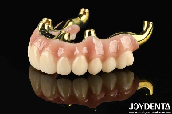 การฟื้นฟูหน้าที่การเคี้ยว สะพานไฮบริด Ti-Bar Zirconia ด้วยความเข้ากันได้อย่างสูงและความเหมาะสมอย่างละเอียด