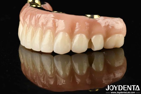 เปลี่ยนแปลงการฟื้นฟูฟันของคุณด้วย Ti-Bar Zirconia Hybrid Bridge ทนทานและยาวนาน