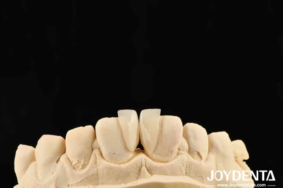 ความทนทานสูง Micro Veneer ความหนา 0.2 มิลลิเมตร และการทํางานที่น่าเชื่อถือ