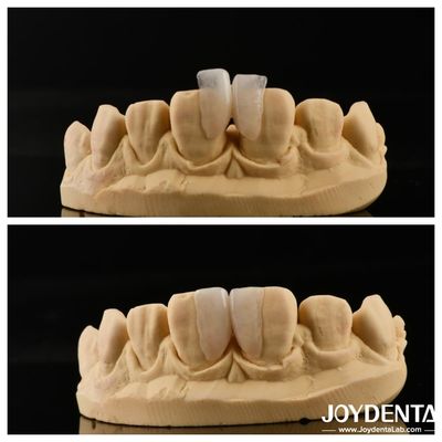 ง่ายในการติดตั้ง Micro Veneer การแก้ไขสุดยอดสําหรับตกแต่งภายใน ความหนา 0.2mm