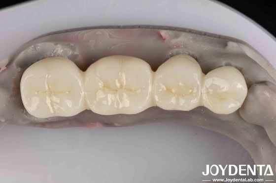 ผลิตภัณฑ์สีขาวดีมาก ซิรคอนีย์เต็ม ด้วยความทนทานต่อการกัดกรองสูง