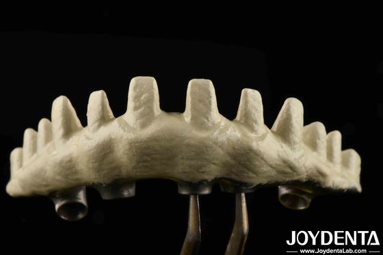 ประเภทการเชื่อมต่อ Hex ภายใน อุปกรณ์ที่กําหนดเอง Abutments การปลูกฝังทรายและกรดกรดสําหรับความเหมาะสมที่ดี