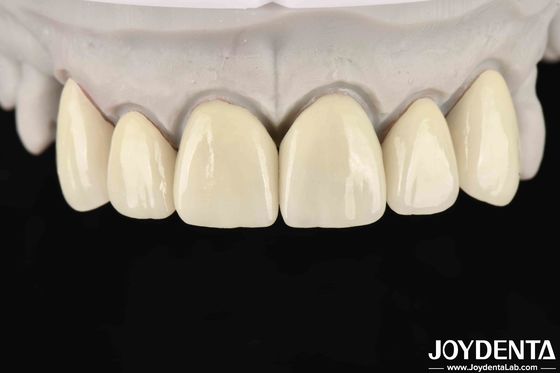 60.0-6.1 G/cm3 ความหนาแน่น Zirconia ชั้นสําหรับความโปร่งใสสูงใน CAD / CAM Milling
