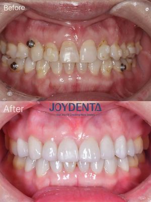 การฟื้นฟูช่องปาก