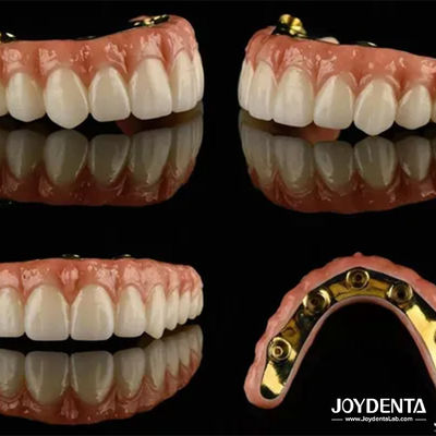 Ti Bar Zirconia Hybrid Implant Bridges ความโปร่งใสสูง สําหรับขั้นแต่งฟัน