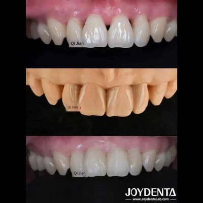 แผ่นผิวขี้หญ้า แก้ไขที่สมบูรณ์แบบสําหรับ แผ่นผิวขี้หญ้า