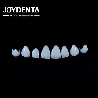 0.3-0.5 มิลลิเมตร หนา โปรเซลีนธรรมชาติ Emax Veneers ความแข็งแรงสูง ยาวนานสําหรับความสวยงาม