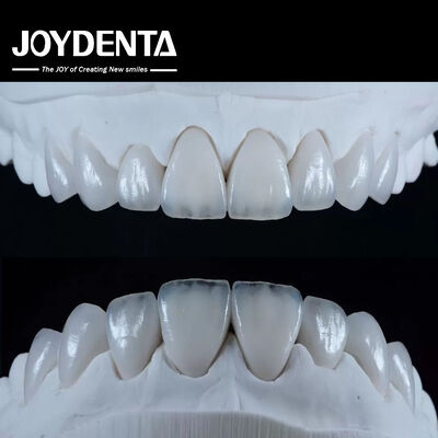 สภาพธรรมชาติ Emax Porcelain Veneer สะดวกสบาย Fit Ultra Thin Emax Veneers