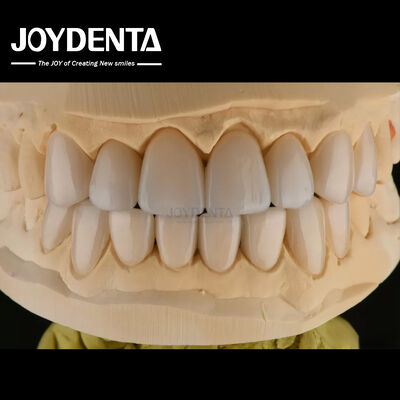 0.3-0.5 มิลลิเมตร หนา Feldspathic Porcelain Veneer ทนต่อการแตกสูง ปรับปรุงรอยยิ้มของคุณ
