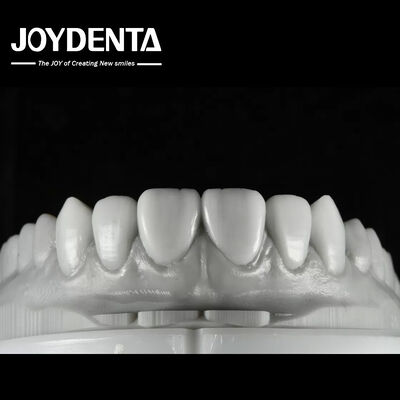 สีธรรมชาติฟัน Wax Up การแก้ไขที่หลากหลายสําหรับการฟื้นฟูฟันเดียวหรือหลายฟัน